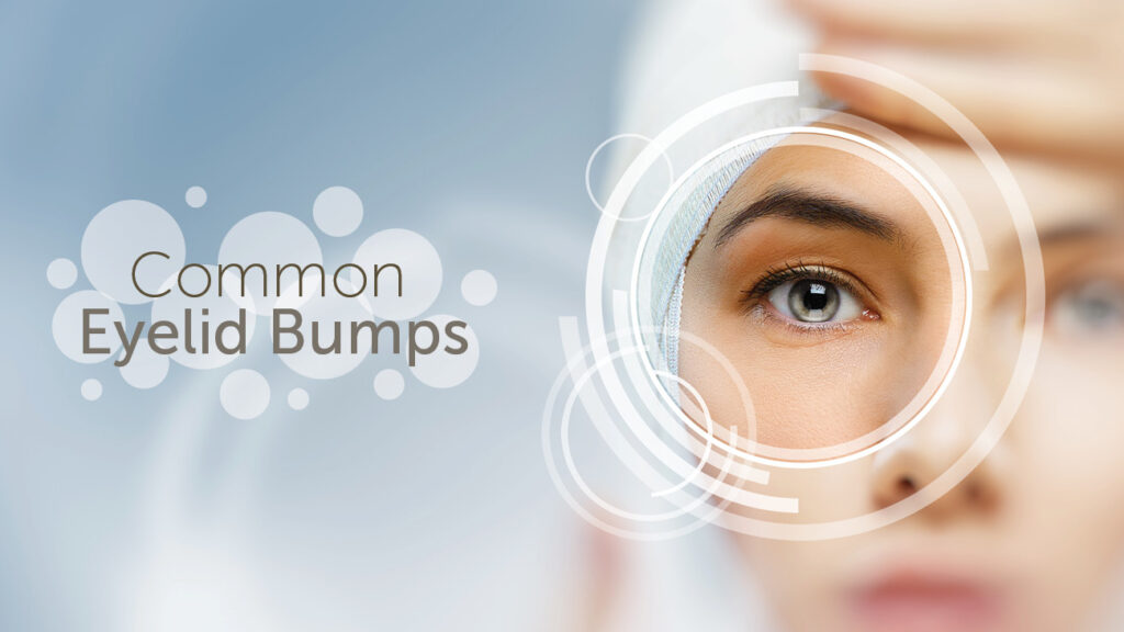 Common Eyelid Bumps